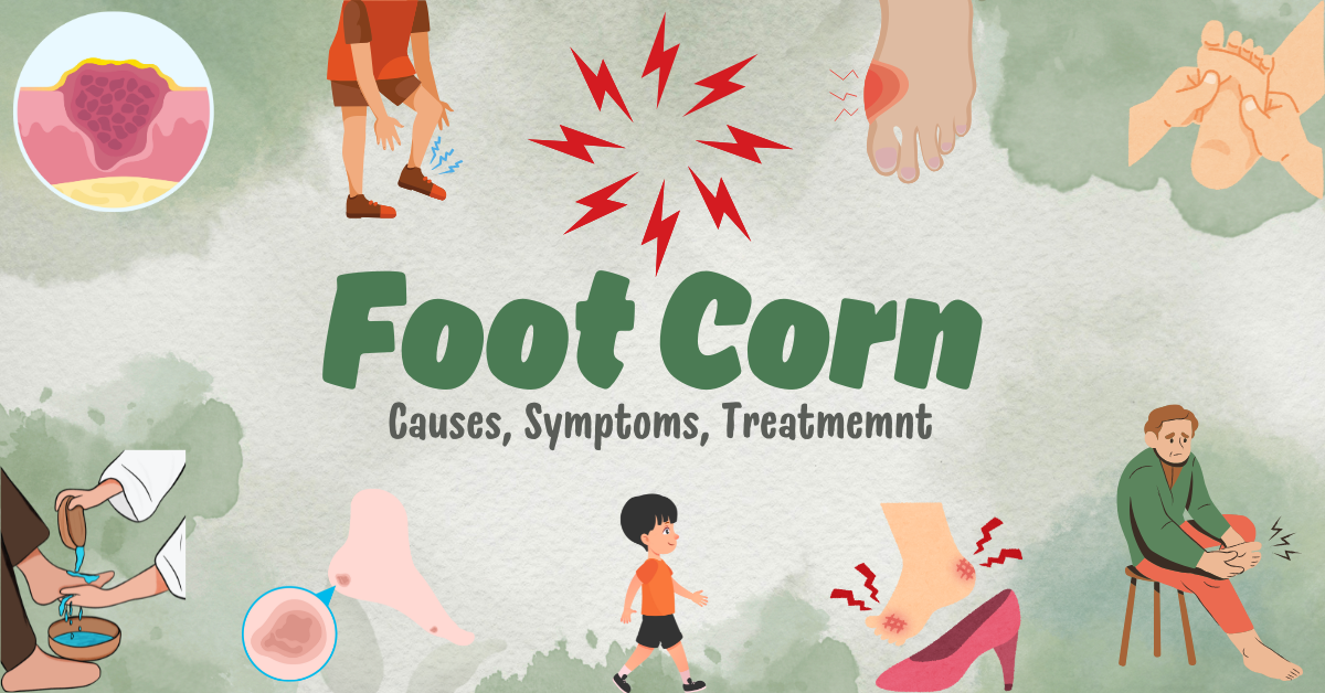 Foot Corn Treatment: Best Medicine & Remedies | SurgiNatal